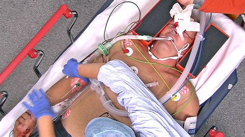 24 Hours in A&E Season 10 Episode 14 - Stronger Together