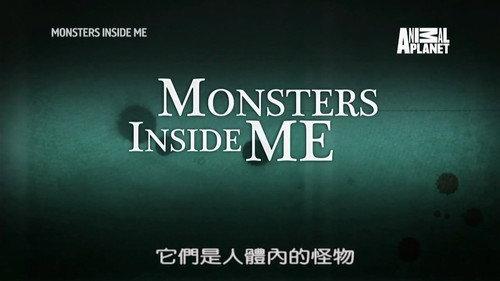 Monsters Inside Me Season 7 Episode 4 - My Wife is Rotting